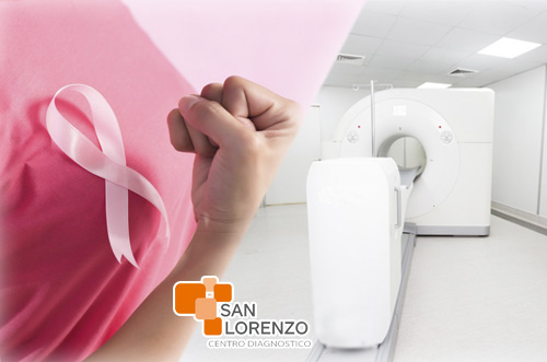 PET-CT y su aporte al tratamiento del cáncer de mama