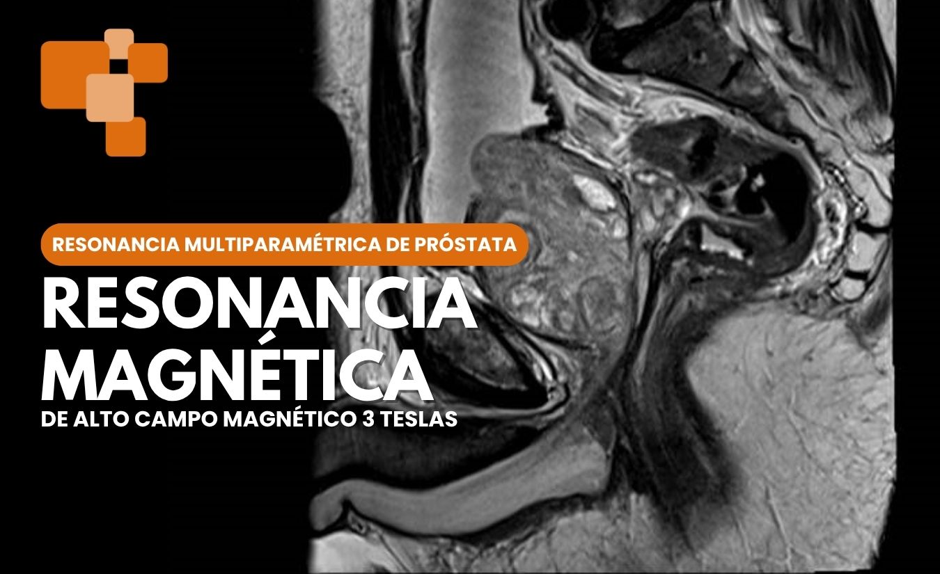 Resonancia magnética de próstata